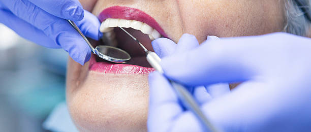 Best Broken or Chipped Tooth Repair in Byron, GA